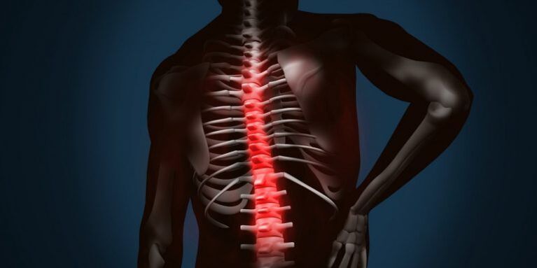 osteochondrosis okozta gerinc elváltozások
